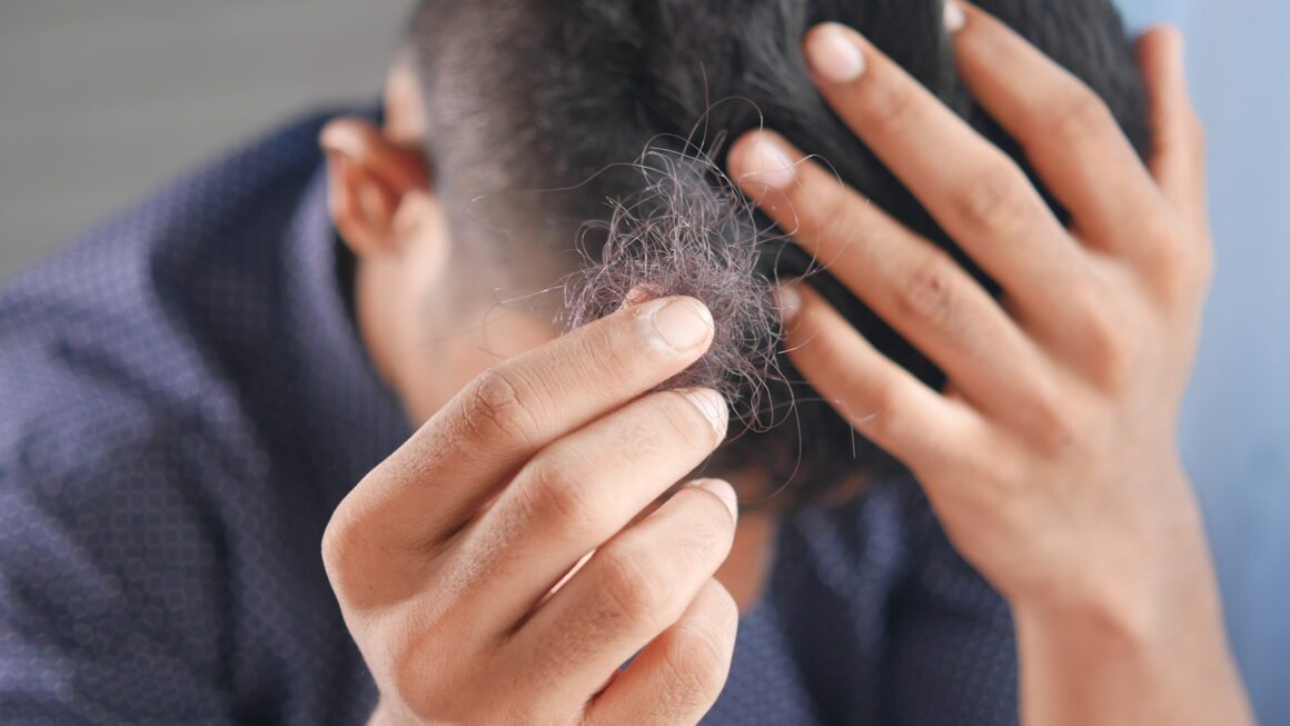 9 choses sur la greffe de cheveux