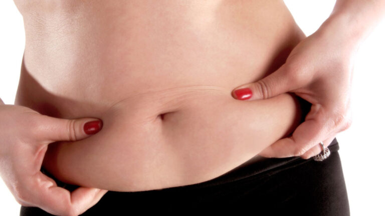 Faire une abdominoplastie : l’essentiel à connaître avant de se lancer dans cette chirurgie esthétique ?